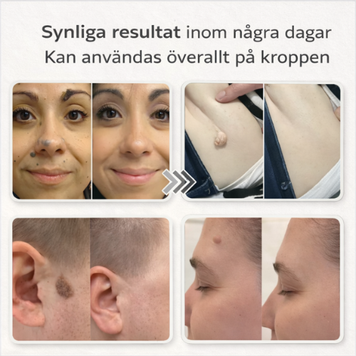 Lovera Care - Hudlappar