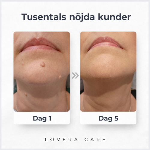 Lovera Care - Hudlappar