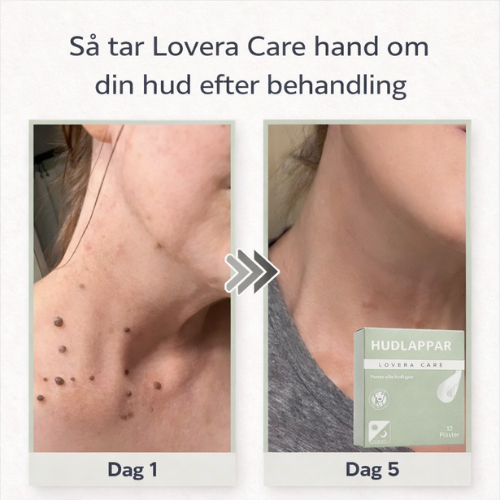 Lovera Care - Hudlappar